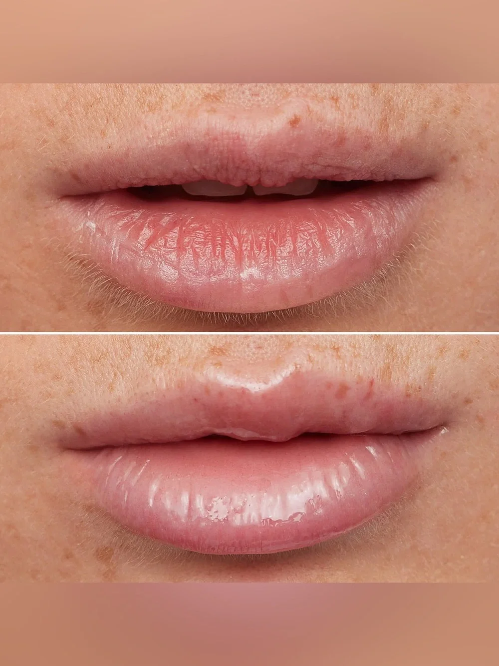 WONDERSKIN Lip Rehab Serum Oil in Clear. NIB 3.57 ml / 0.12 Oz